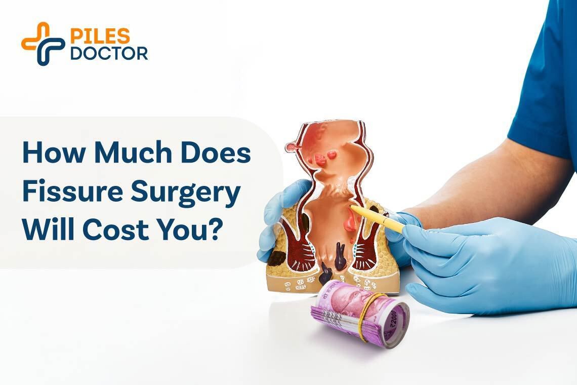 Fissure Surgery Cost