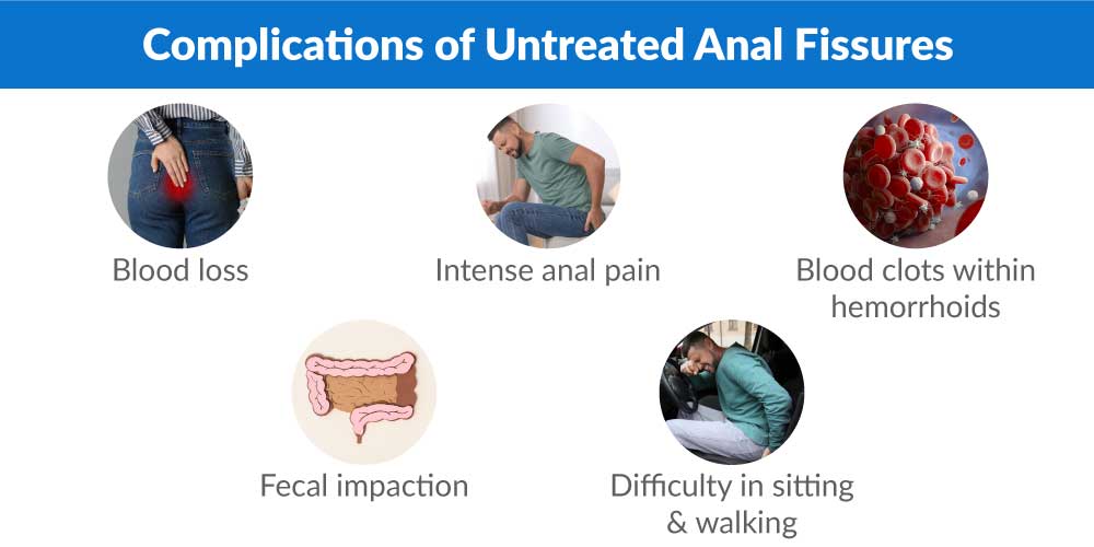 Anal treatment