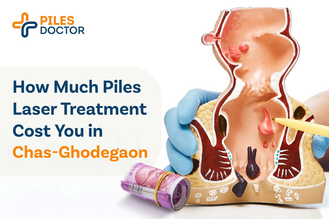 Piles Laser Treatment Cost in Chas-Ghodegaon