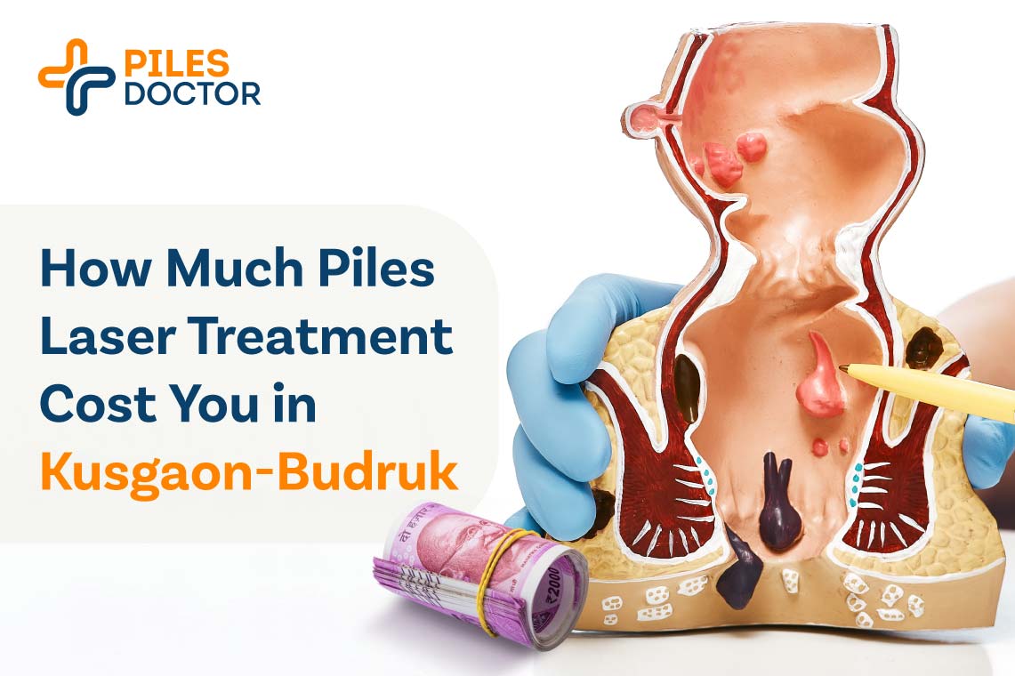 Piles Laser Treatment Cost in Kusgaon-Budruk