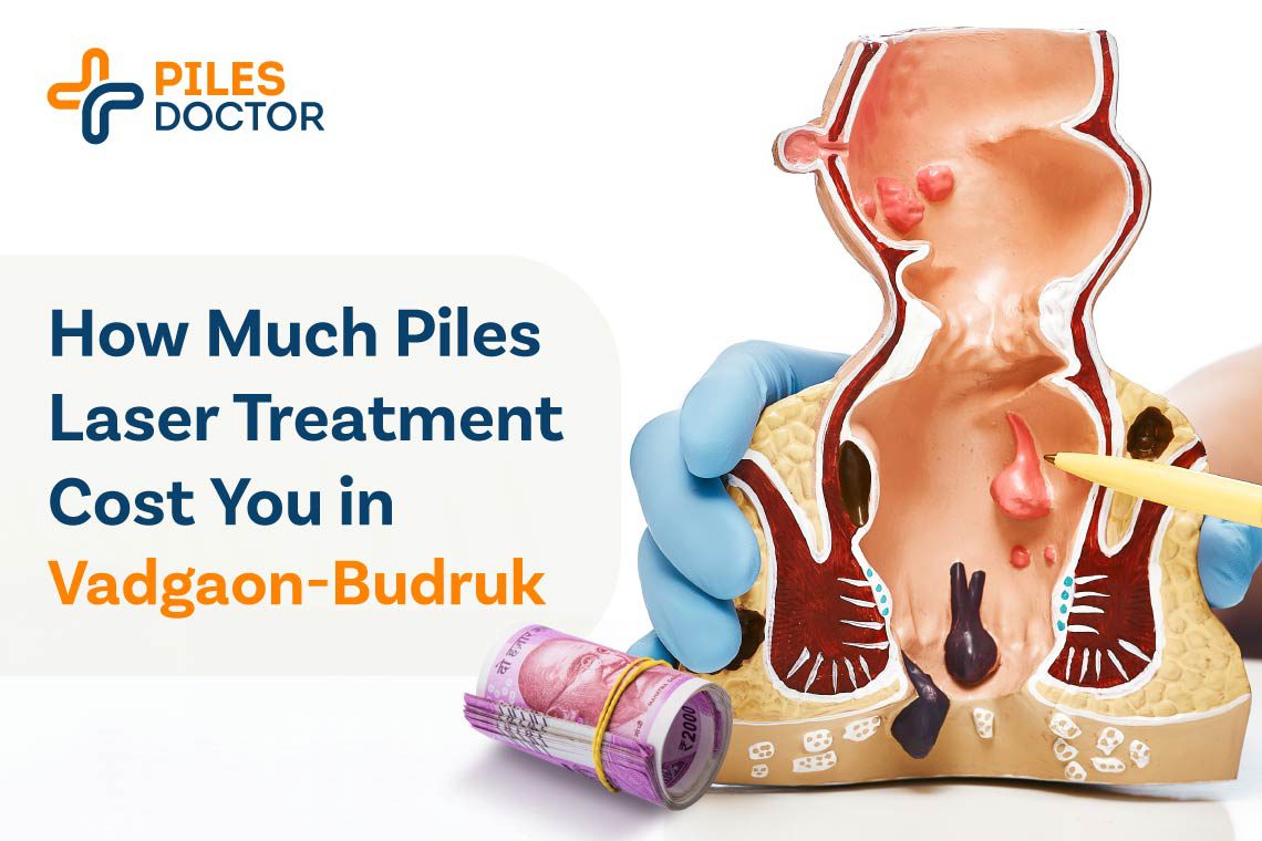 Piles Laser Treatment Cost in Vadgaon-Budruk