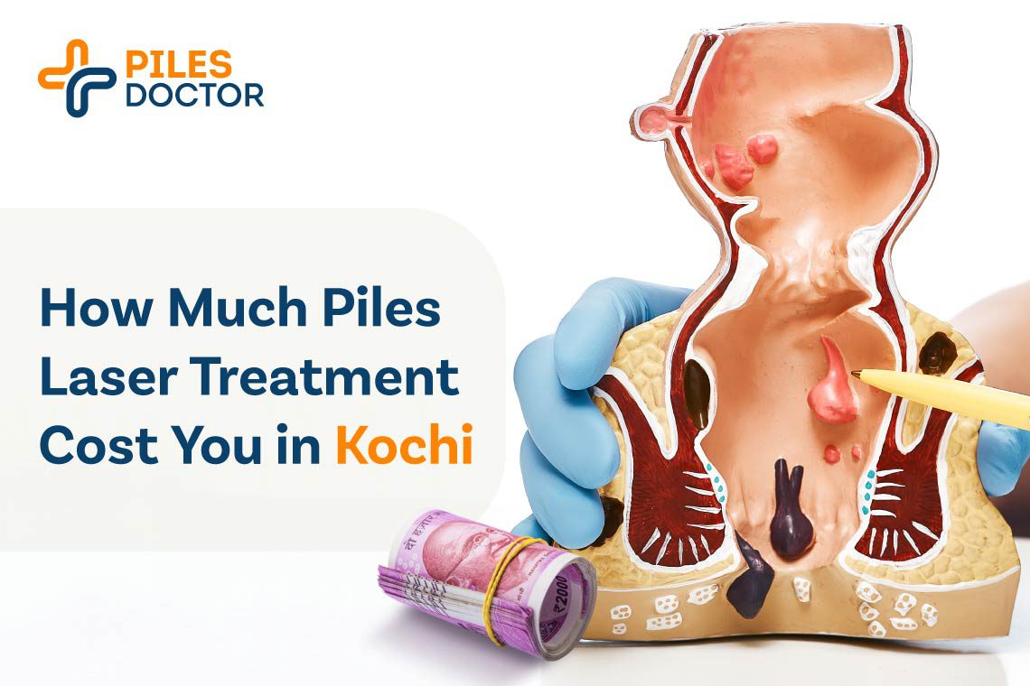Piles Laser Treatment Cost in Kochi