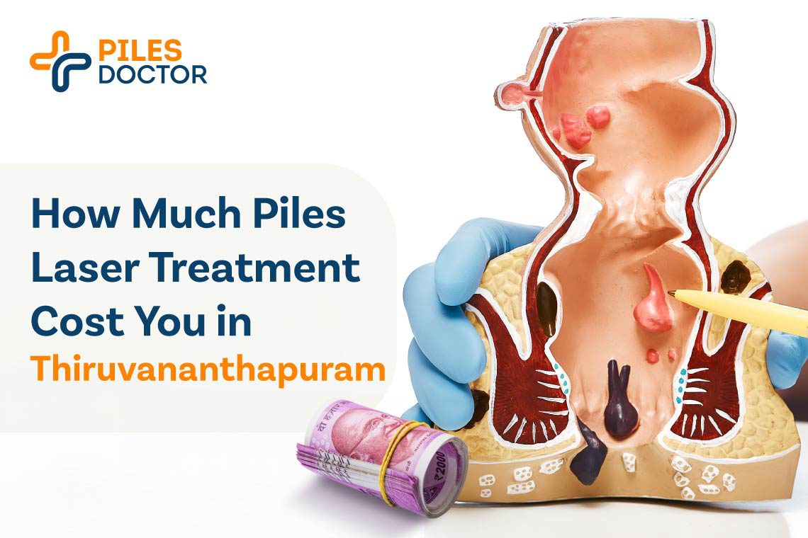 Piles Laser Treatment in Thiruvananthapuram