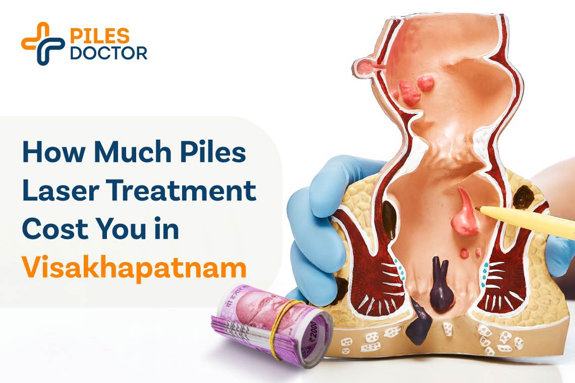 Piles Laser Treatment Cost in Visakhapatnam