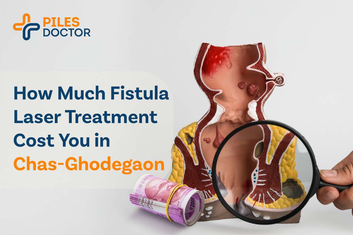 fistula laser treatment cost in chas-ghodegaon