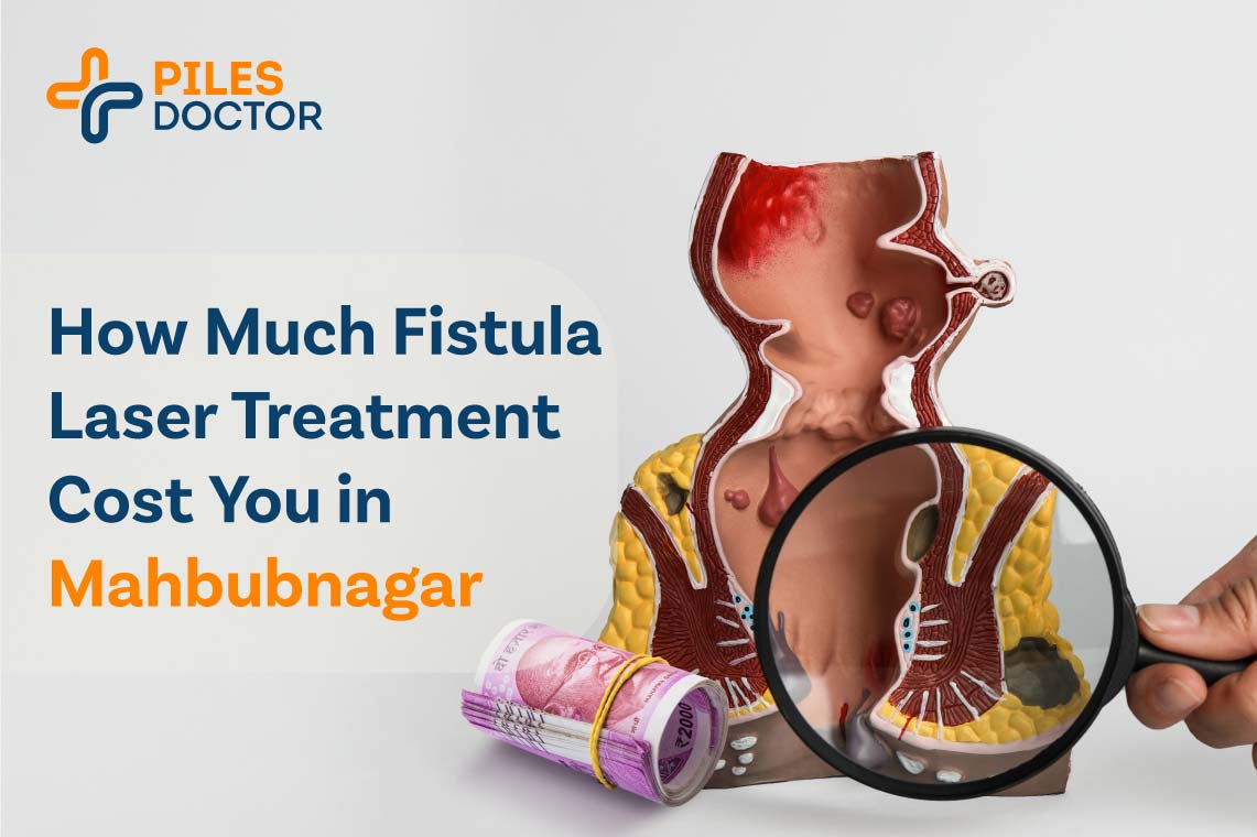 fistula laser treatment cost in mahbubnagar