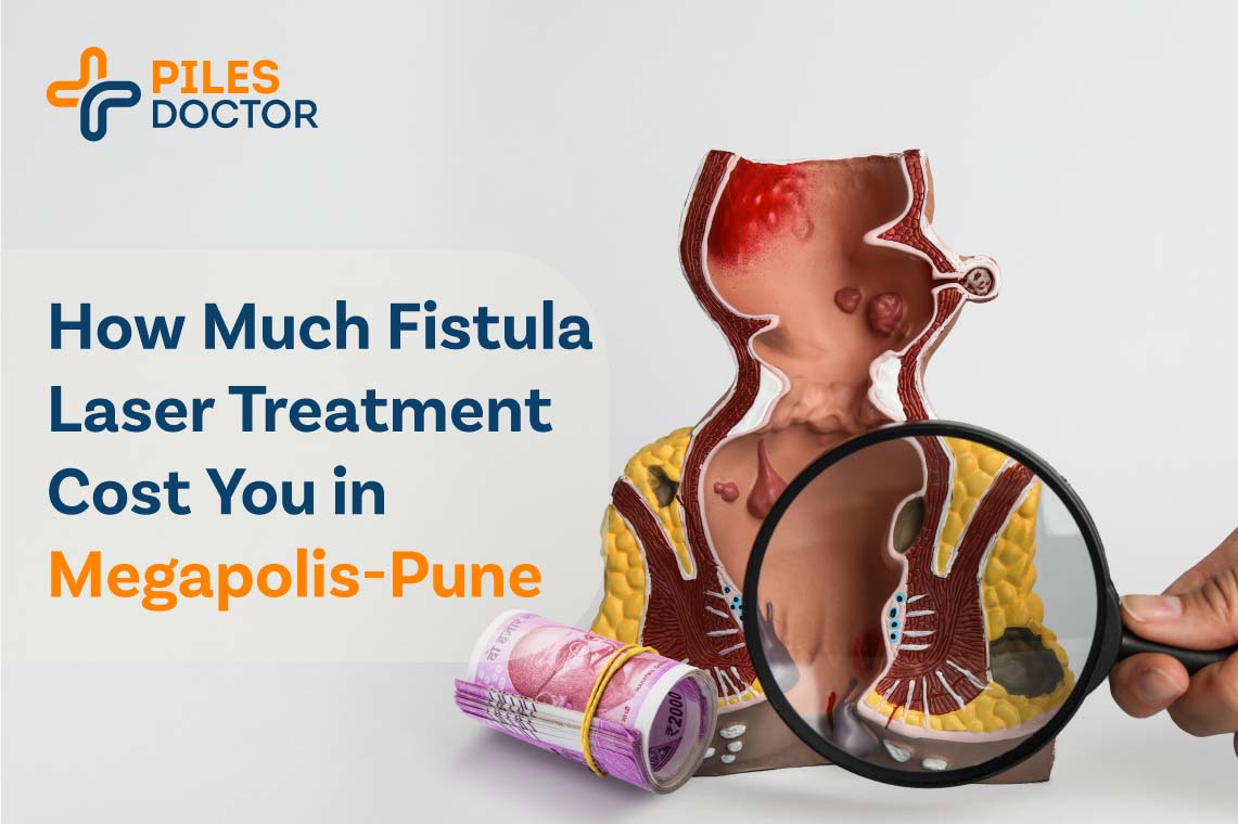 fistula laser treatment cost in megapolis-pune